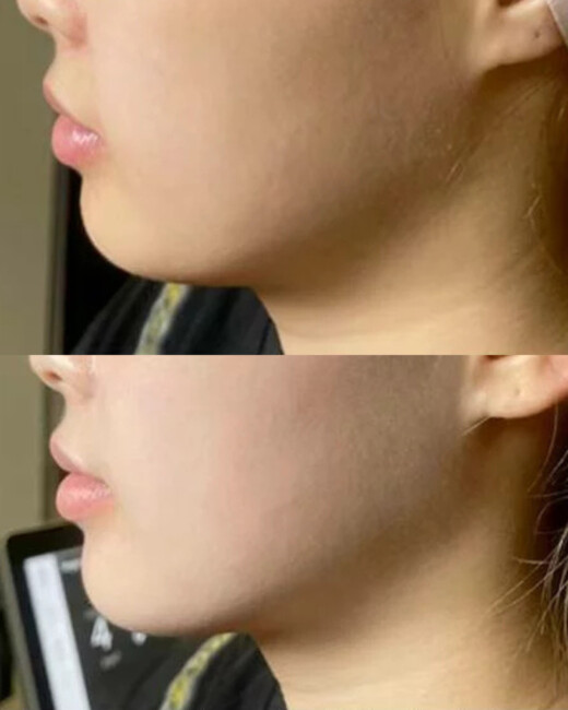 hello skinbeforeandafter